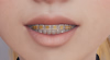 1756773040358.png
